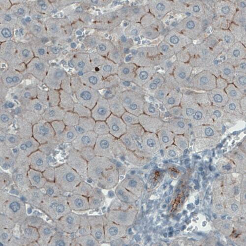 Staining of human liver shows membranous immunoreactivity in hepatocytes.