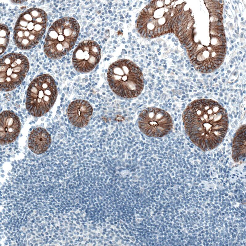 Staining of human colon shows strong membranous positivity in glandular cells.