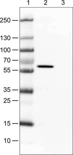 Lane 1: Marker [kDa]Lane 2: Human cell line CACO-2Lane 3: Human cell line U-87