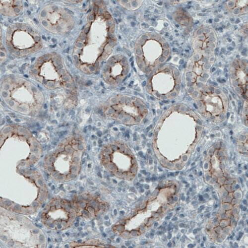 Staining of human kidney shows membranous positivity in renal tubules.