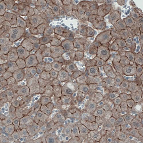 Staining of human liver shows membranous immunoreactivity in hepatocytes.