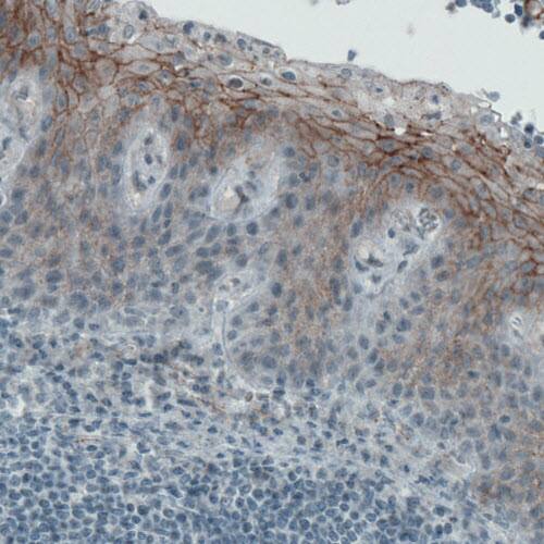 Staining of human tonsil shows membranous immunoreactivity in squamous epithelium cells.