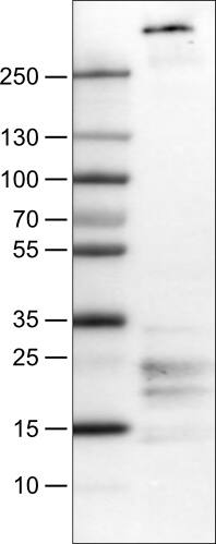 Lane 1: Marker [kDa]Lane 2: Human tonsil tissue lysate
