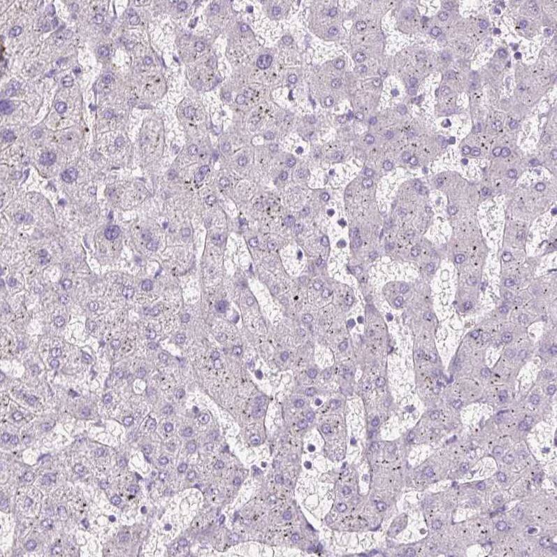 Staining of human liver shows no positivity in hepatocytes as expected.