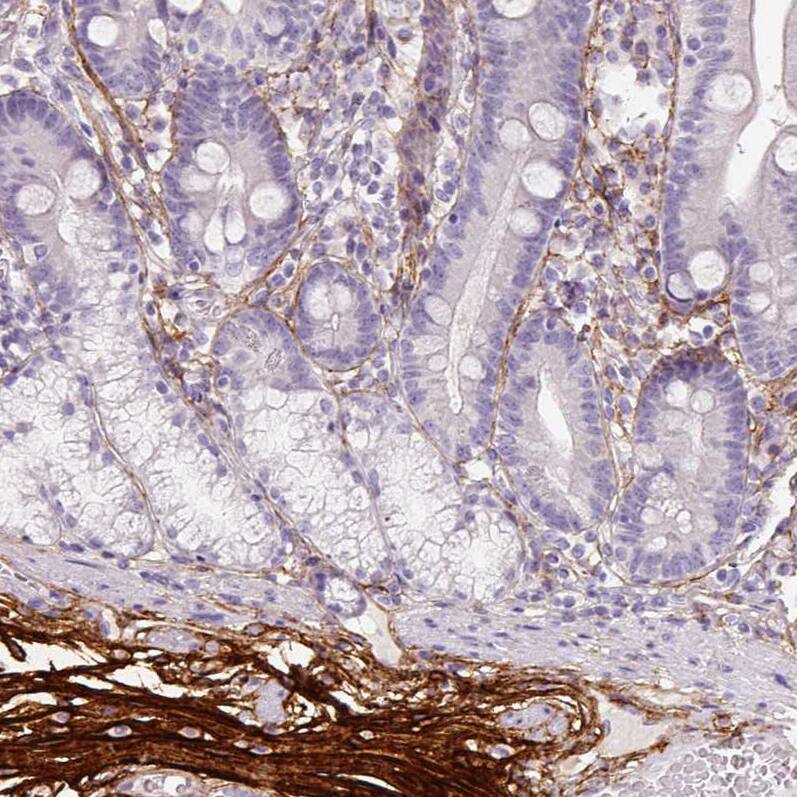 Staining of human duodenum shows moderate to strong positivity in extracellular matrix.