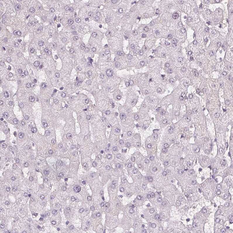 Staining of human liver shows no positivity in hepatocytes as expected.