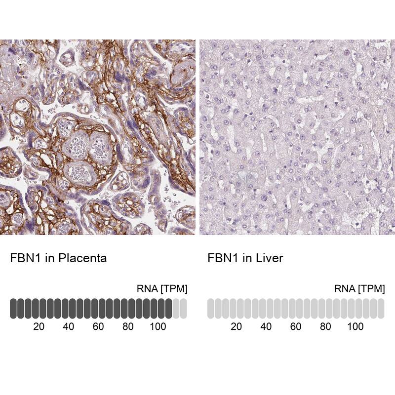 Analysis in human placenta and liver tissues using NBP3-43906 antibody. Corresponding Fibrillin 1 RNA-seq data are presented for the same tissues.