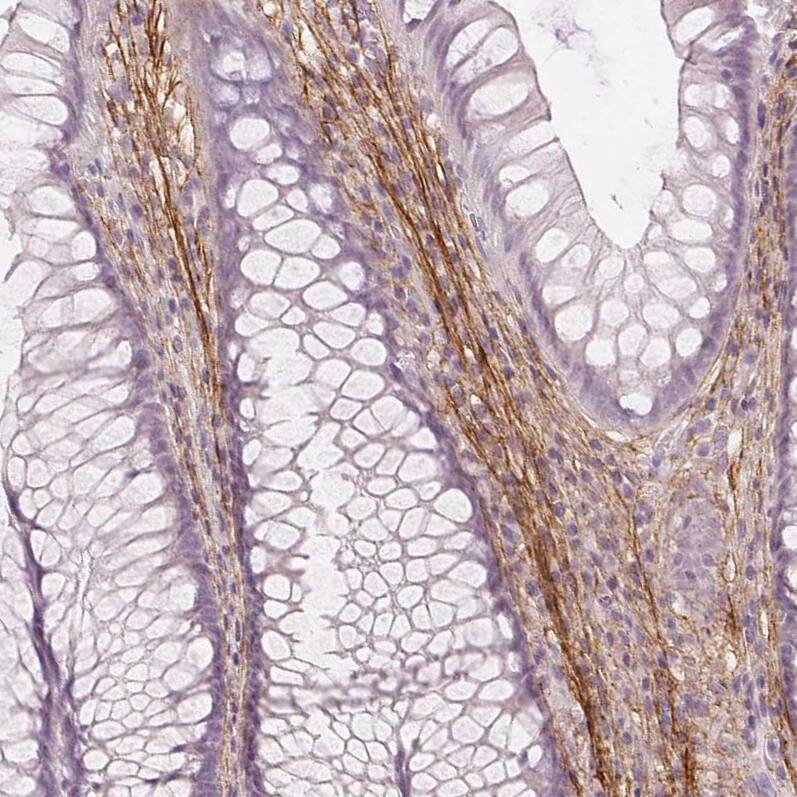 Staining of human rectum shows strong positivity in the extracellular matrix.