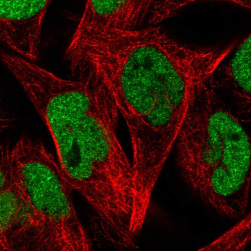 Staining in RH30 cell line with Anti-ZEB1 monoclonal antibody) staining in green. Microtubule probes are visualized in red (where available).