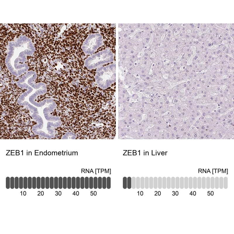 Analysis in human endometrium and liver tissues using NBP3-43907 antibody. Corresponding ZEB1 RNA-seq data are presented for the same tissues.