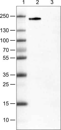 Lane 1: Marker [kDa]Lane 2: Human cell line RH-30Lane 3: Human cell line CACO-2