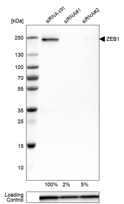 Analysis in Rh30 cells transfected with control siRNA, target specific siRNA probe #1 and #2, using Anti-ZEB1 antibody. Remaining relative intensity is presented. Loading control: Anti-GAPDH.