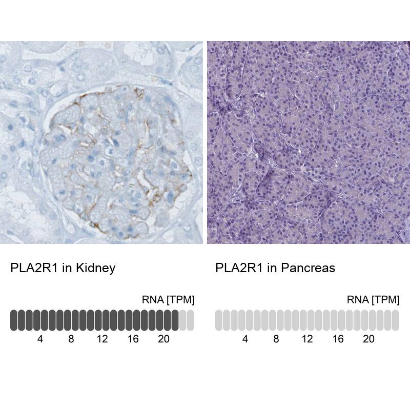 Analysis in human kidney and pancreas tissues using NBP3-43909 antibody. Corresponding PLA2R1 RNA-seq data are presented for the same tissues.