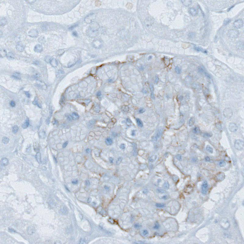 Staining of human kidney shows weak membranous positivity in cells in glomeruli.