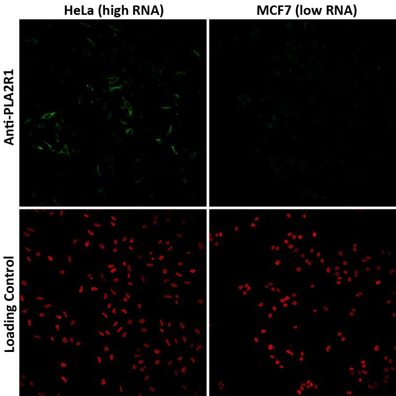 Staining in human cell lines Hela and MCF7 exhibiting a relatively high and low expression of PLA2R1 (based on RNA-seq values)) is present in Hela cells but is absent in MCF7 cells. The anti-HDAC1 antibody was used as a loading control (red signal).