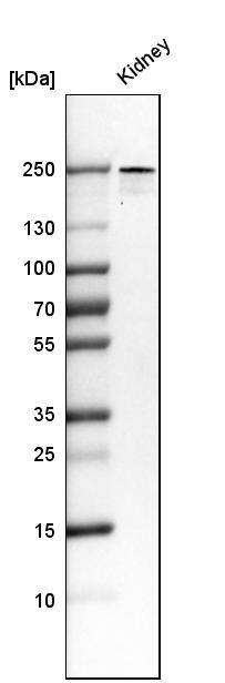 Analysis in human kidney tissue.