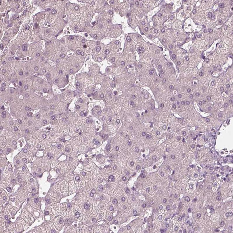 Staining of human liver shows no positivity in hepatocytes as expected.