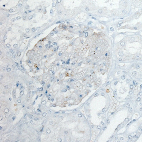 Staining of normal human kidney shows very weak membranous positivity in cells in glomeruli.