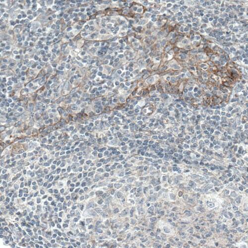 Staining of human tonsil shows moderate membranous immunoreactivity in squamous epithelial cells.