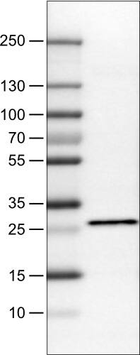 Lane 1: Marker [kDa]Lane 2: Human cell line RT-4