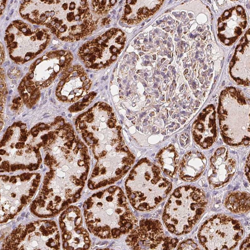 Staining of human kidney shows strong granular cytoplasmic positivity in cells in tubules.
