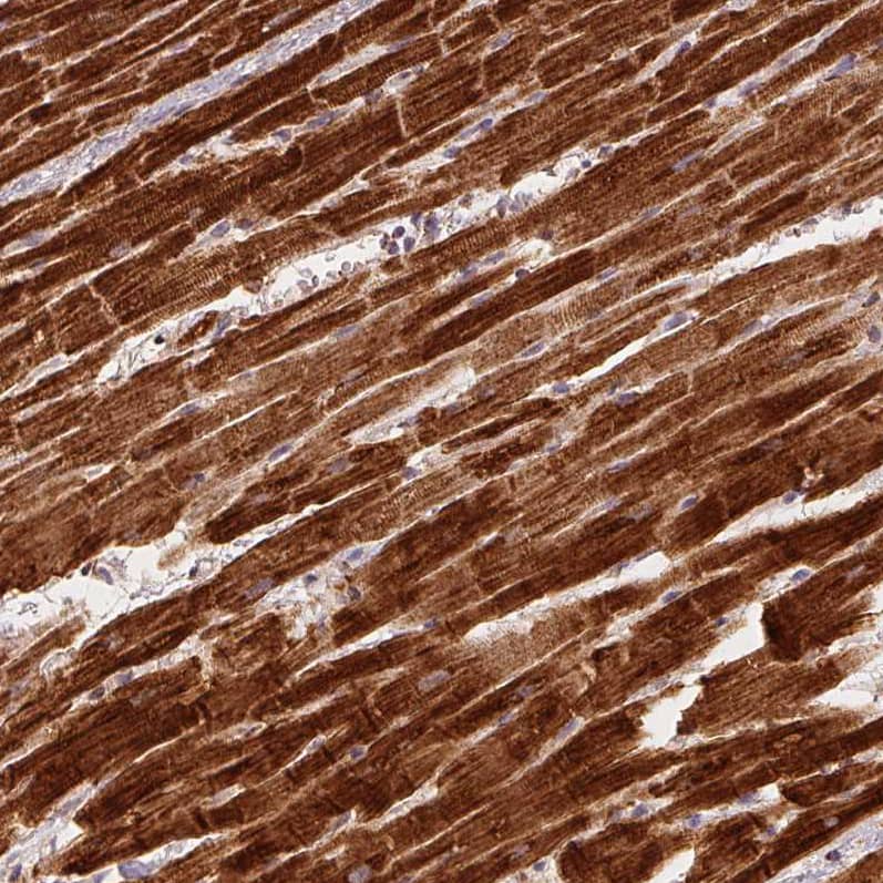 Staining of human heart shows strong cytoplasmic positivity in cardiomyocytes.
