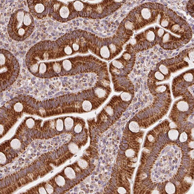 Staining of human small intestine shows strong cytoplasmic positivity in glandular cells.