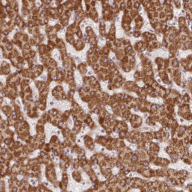 Staining of human liver shows strong granular cytoplasmic positivity in hepatocytes.