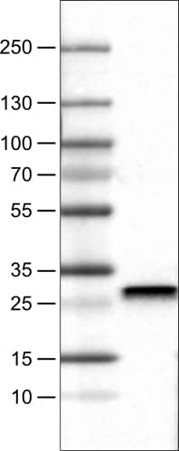 Lane 1: Marker [kDa]Lane 2: Human cell line RT-4
