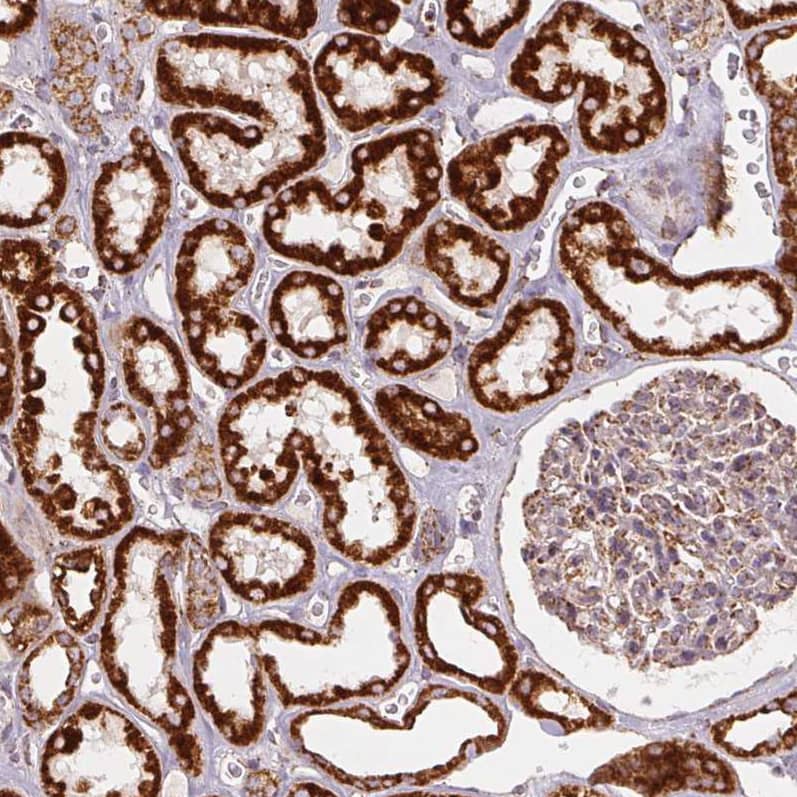 Staining of human kidney shows strong positivity in cells in tubules.
