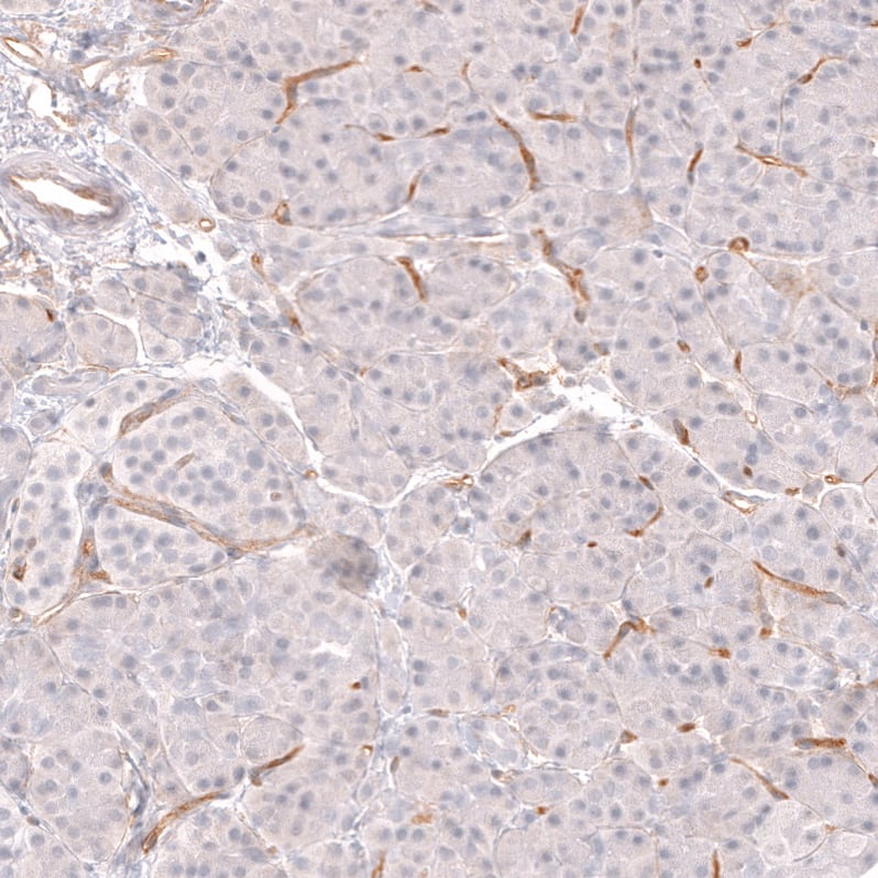 Staining of human pancreas shows moderate membranous positivity in endothelial cells.