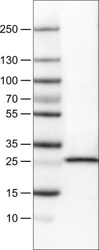 Lane 1: Marker [kDa]Lane 2: Human cell line RT-4