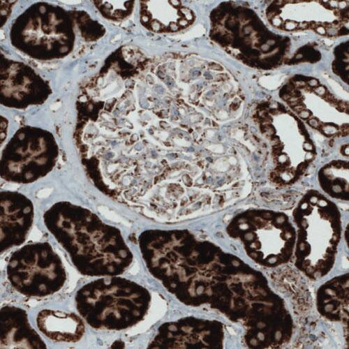 Staining of human kidney shows strong cytoplasmic positivity in renal tubules.