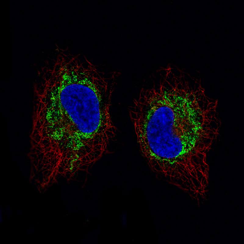 Staining of A549 cells using the Anti-SDHB monoclonal antibody) .