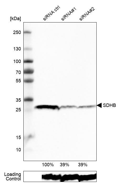 Analysis in RT-4 cells transfected with control siRNA, target specific siRNA probe #1 and #2, using Anti-SDHB antibody. Remaining relative intensity is presented. Loading control: Anti-PPIB.