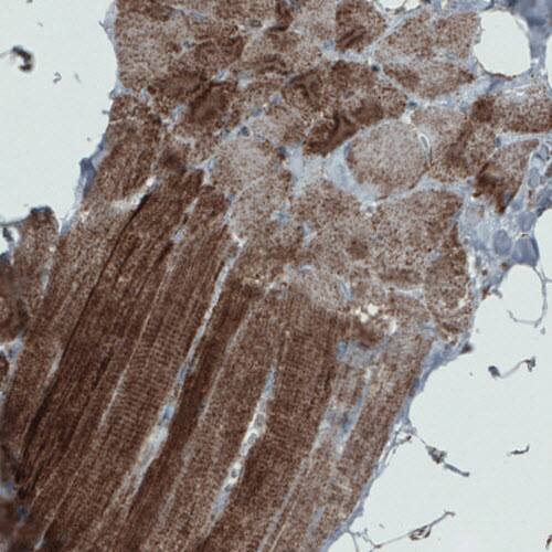 Staining of human skeletal muscle shows granular cytoplasmic positivity in muscle fibers.