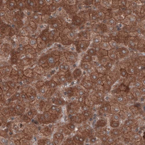 Staining of human liver shows cytoplasmic positivity in hepatocytes.