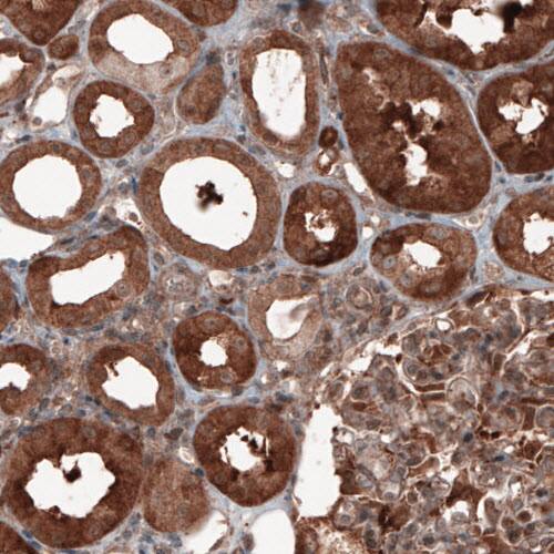 Staining of human kidney shows cytoplasmic positivity in renal tubules and glomerulus cells.