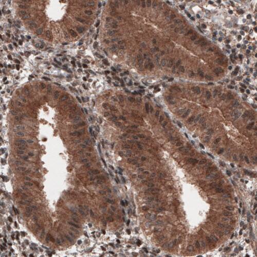 Staining of human endometrium shows cytoplasmic immunoreactivity in glandular epithelium cells.