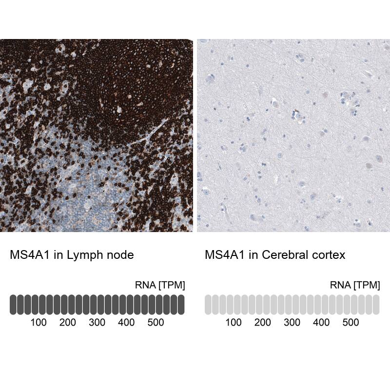 Analysis in human lymph node and cerebral cortex tissues using NBP3-43919 antibody. Corresponding CD20 RNA-seq data are presented for the same tissues.