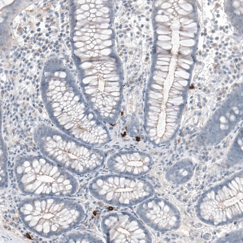 Staining of human colon shows strong membranous positivity in a small subset of  lymphoid cells.