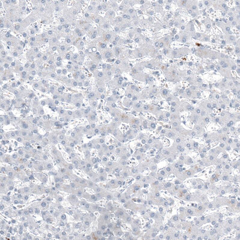 Staining of human liver shows no positivity in hepatocytes as expected.
