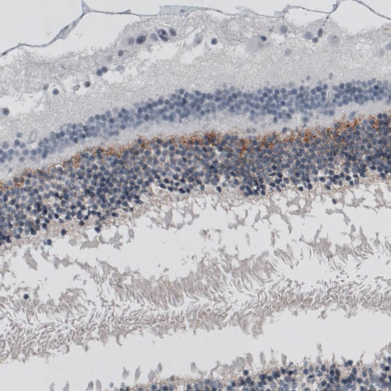 Staining of human eye retina shows moderate positivity in the outer plexiform layer.