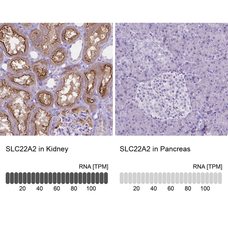 Analysis in human kidney and pancreas tissues using NBP3-43921 antibody. Corresponding SLC22A2/OCT2 RNA-seq data are presented for the same tissues.