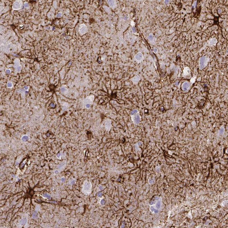 Staining of human cerebral cortex shows strong membranous positivity in astrocytes.