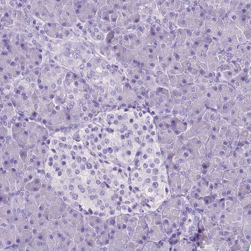 Staining of human pancreas shows no positivity in either exocrine or endocrine glandular cells as expected.