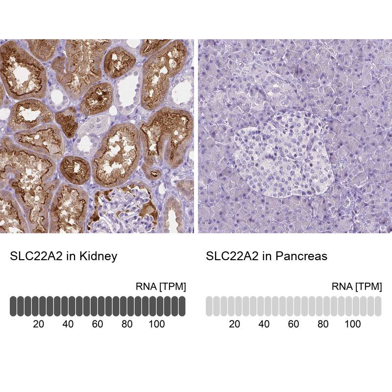 Analysis in human kidney and pancreas tissues using NBP3-43922 antibody. Corresponding SLC22A2/OCT2 RNA-seq data are presented for the same tissues.
