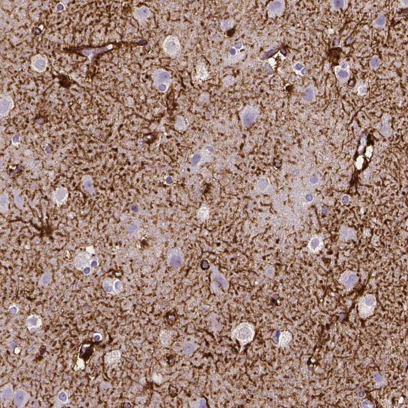 Staining of human cerebral cortex shows strong membranous positivity in astrocytes.
