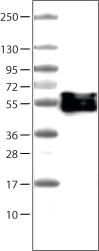 Lane 1: Marker [kDa]  Lane 2: Human tonsil tissue lysate