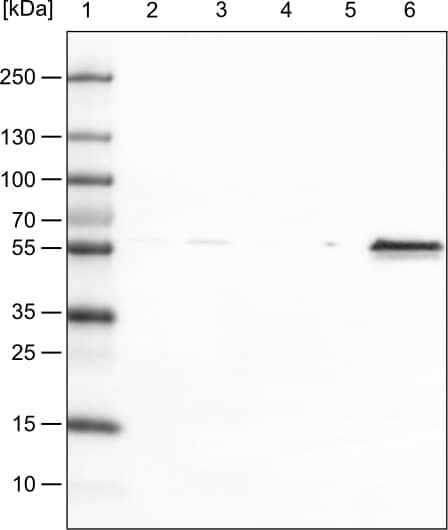 Lane 1: Marker [kDa]Lane 2: Human cell line HeLa cytoplasmic fractionLane 3: Human cell line HeLa membrane fractionLane 4: Human cell line HeLa nuclear fractionLane 5: Human cell line HeLa chromatin fractionLane 6: Human cell line HeLa cytoskeletal fraction